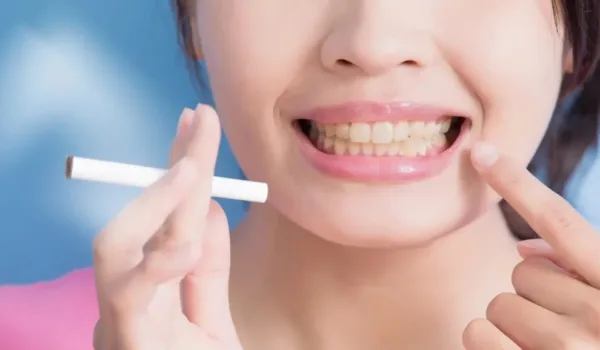 gelere tanden door roken